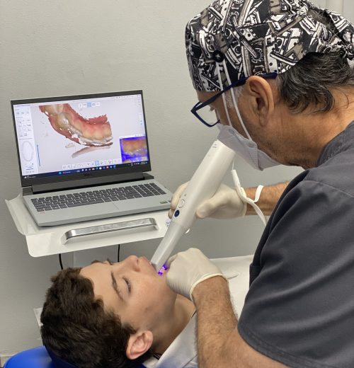 Smart Align Smile Center Alineadores